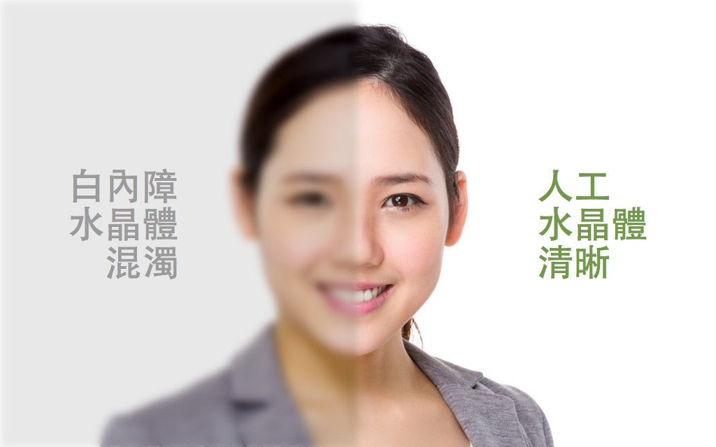 醫治白內障的人工水晶體,好的市價近10萬,健保不給付之下你會選擇他嗎? - Bestmade 人學院