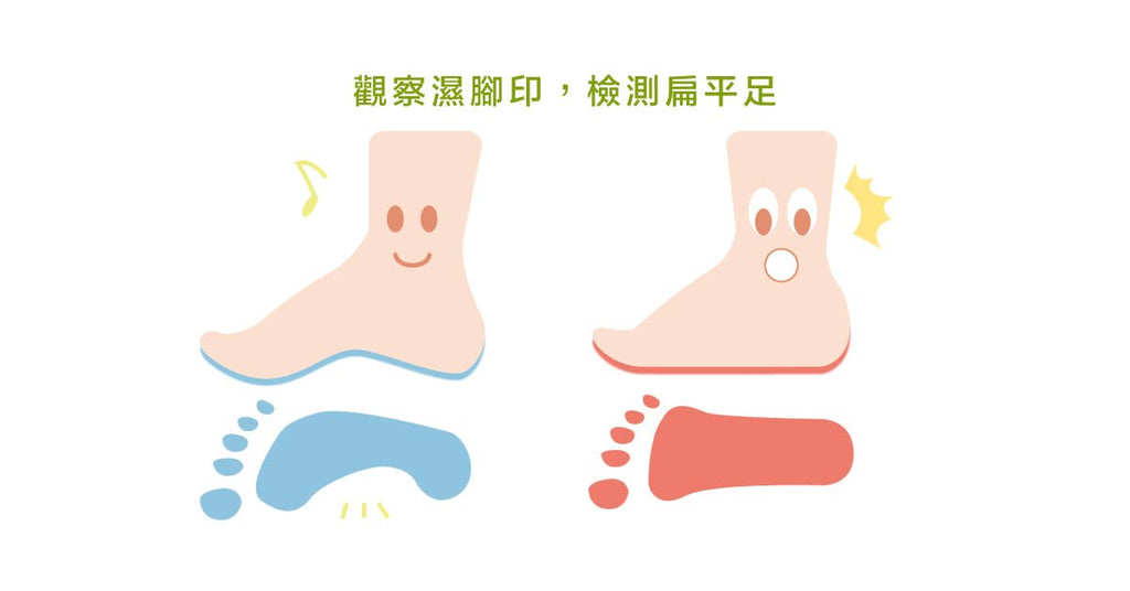 你有扁平足嗎?扁平足矯正運動指南 - Bestmade 人學院