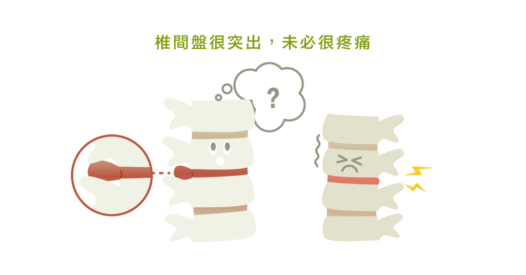 停止影像恐嚇!椎間盤突出也許不需要開刀即能自癒 - Bestmade 人學院