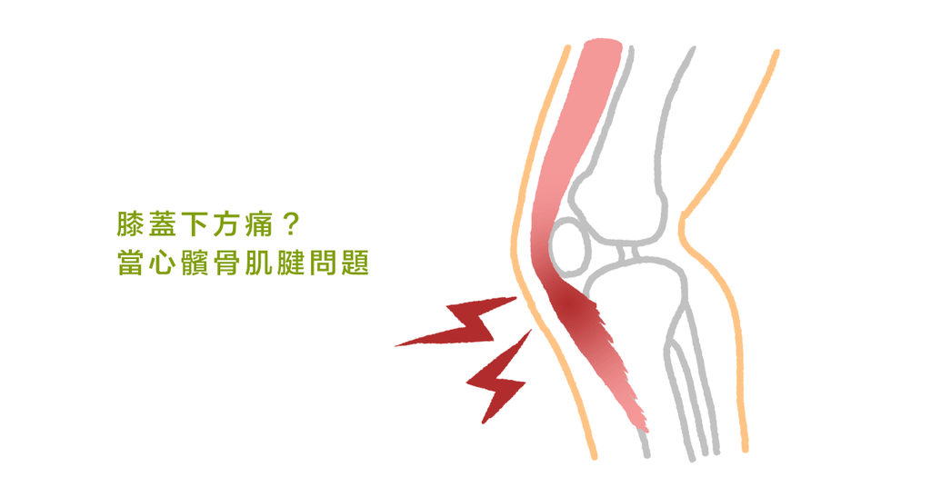 膝蓋痛?最強復健法 (一):認識髕骨肌腱與受傷成因 - Bestmade 人學院