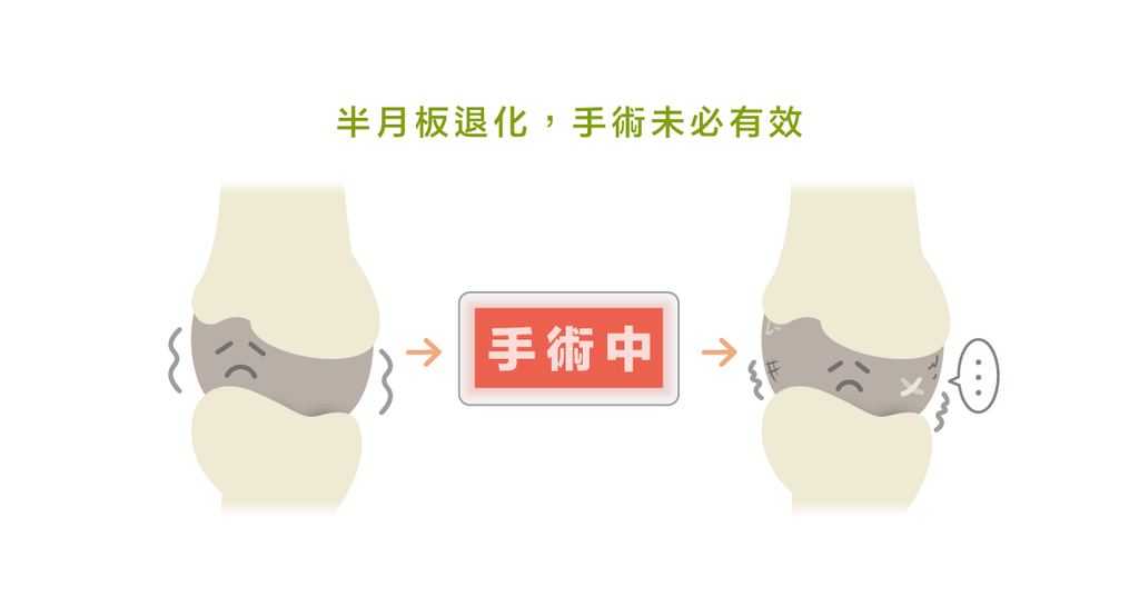進手術房卻不真的開刀?假手術竟然也能改善膝蓋的問題? - Bestmade 人學院