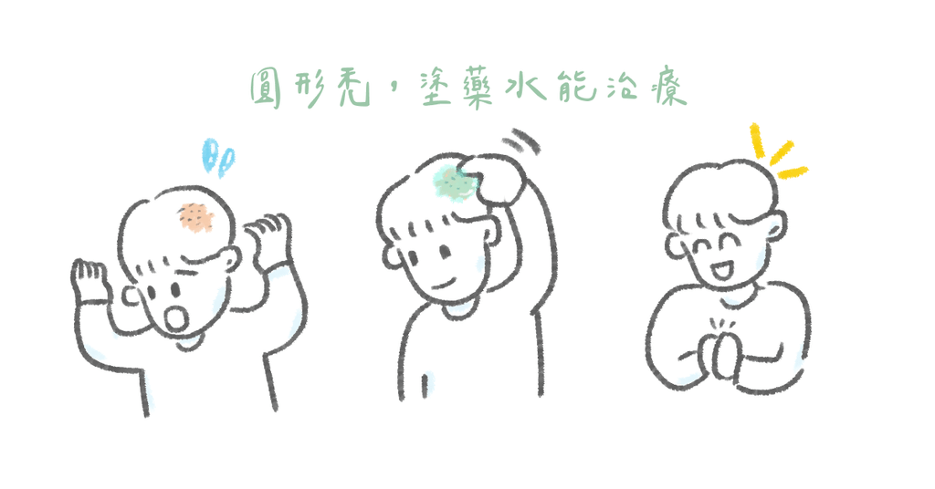 壓力造成鬼剃頭?正確治療可大幅恢復! - Bestmade 人學院