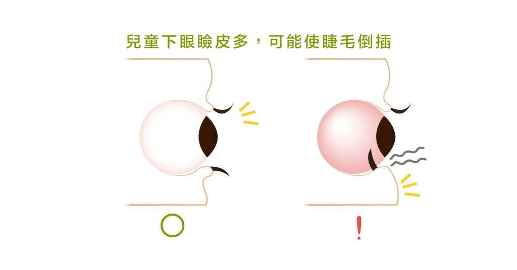 睫毛倒插需要處理嗎? - Bestmade 人學院