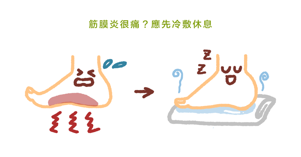 站太久足弓痛!足底筋膜炎到底多久才會好? - Bestmade 人學院