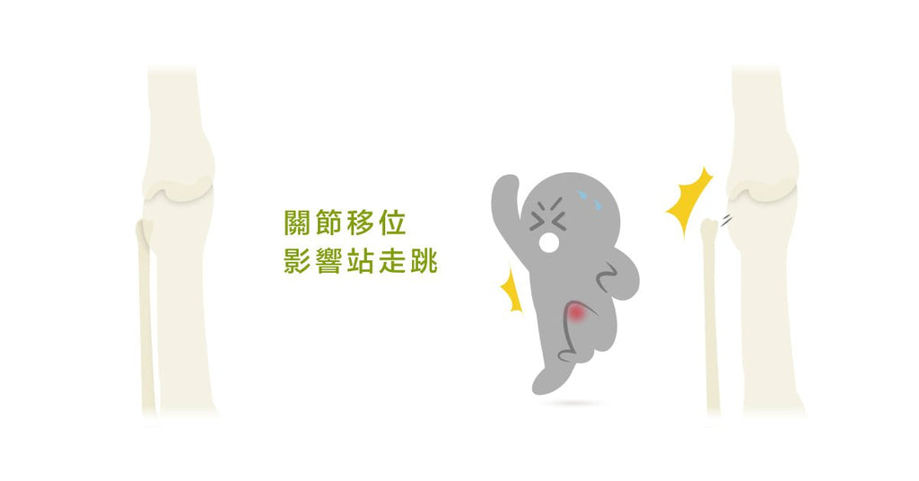 近端脛腓關節 錯位,前十字韌帶術後常被忽略的重點! - Bestmade 人學院