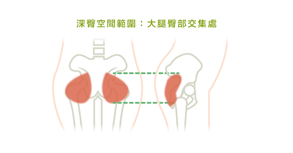 還在用「梨狀肌症候群」這個名詞嗎?已經過時囉! - Bestmade 人學院