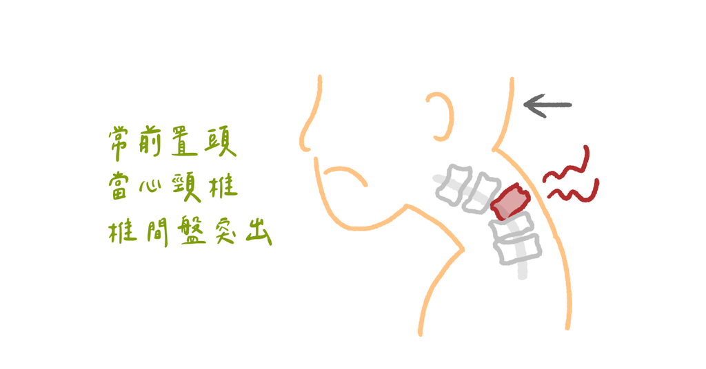 趕快檢視改進,造成身體這裡痠那裡痛的三個居家爛姿勢(上) - Bestmade 人學院