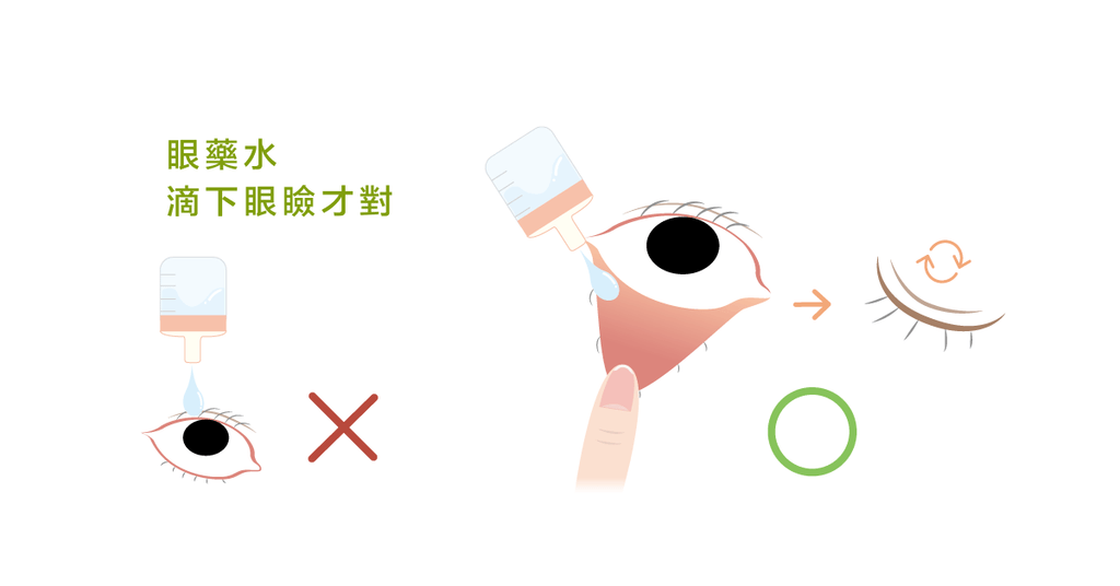 藥師介紹眼藥水與防腐劑--眼藥水使用守則 - Bestmade 人學院