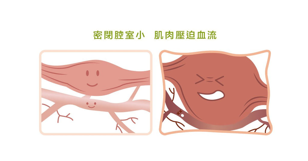 別以為只是肌肉痠痛!忽略這個問題,嚴重恐截肢! - Bestmade 人學院