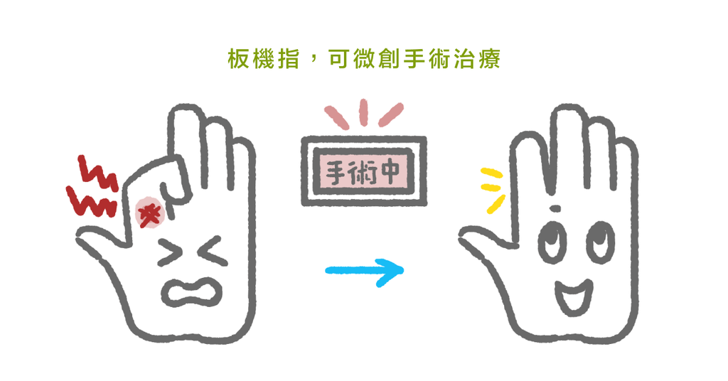 手指頭疼痛伸不直?骨科醫師帶你認識:什麼是板機指(下) - Bestmade 人學院