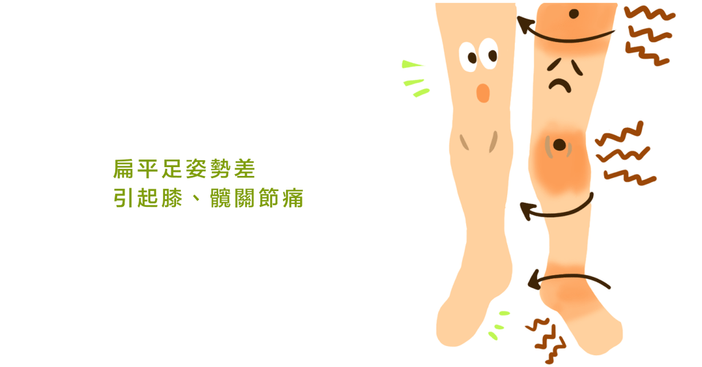 扁平足潛在病症多!骨科醫生:扁平足的檢測與矯正運動(上) - Bestmade 人學院