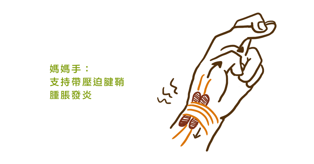 手痛到無法擰毛巾?不是只有媽媽才會得媽媽手,滑鼠用太多也會(上) - Bestmade 人學院