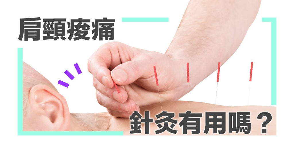 肩頸痠痛針灸有用嗎?如何選擇適合的針灸法? - Bestmade 人學院