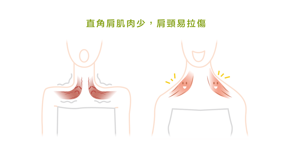 直角肩的迷思--女生一定要有直角肩才好看嗎? - Bestmade 人學院