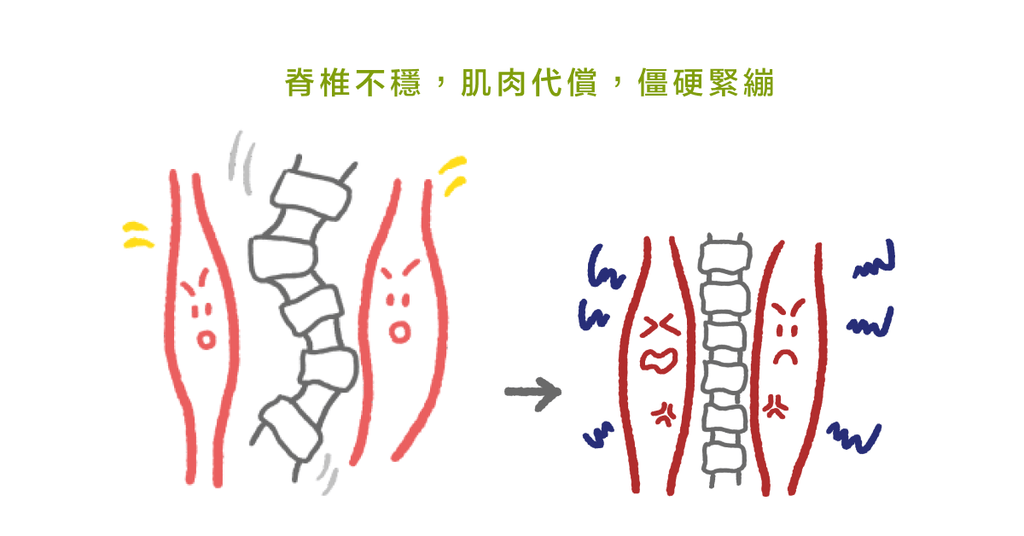 受傷是因為肌肉太緊繃?物理治療師:其實可能無關! - Bestmade 人學院