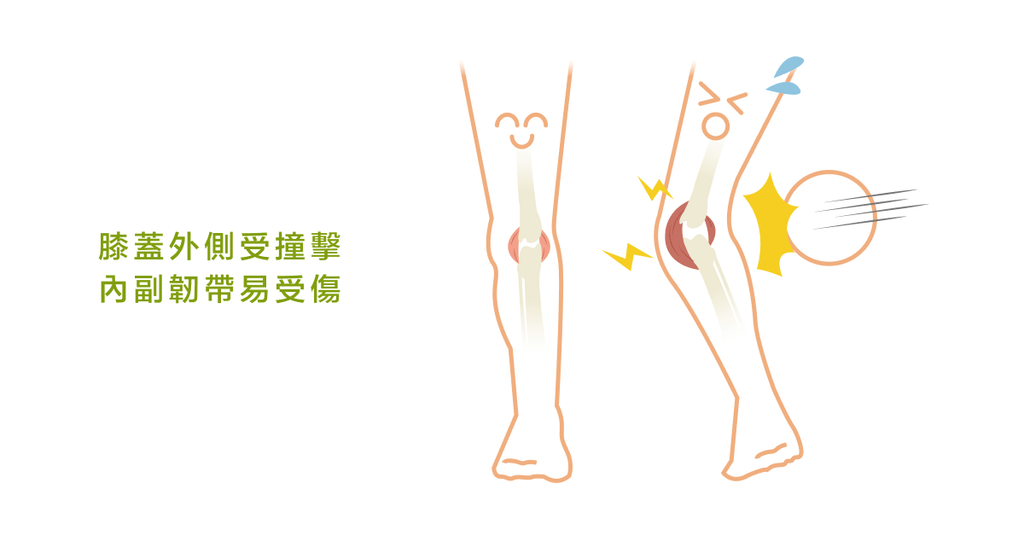 何謂膝蓋內側副韌帶?又有哪些損傷可能性呢? - Bestmade 人學院