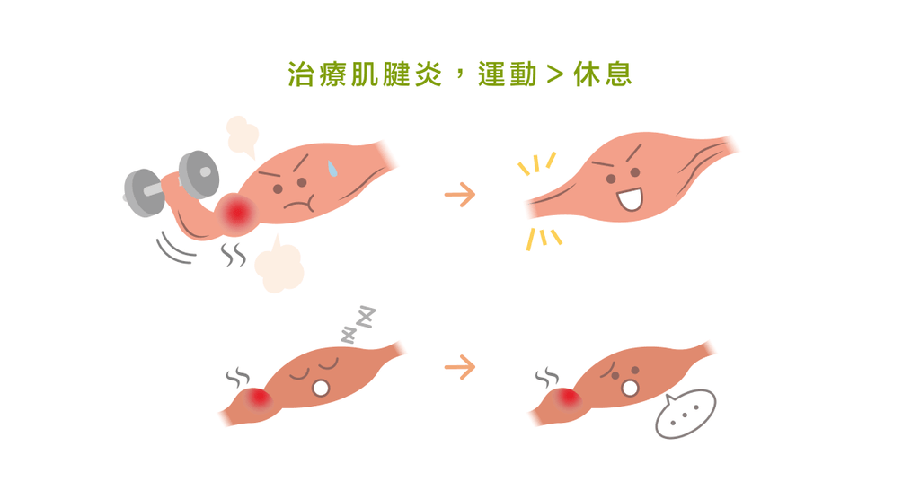 肌腱炎/病變?需要先知道的幾件事 - Bestmade 人學院