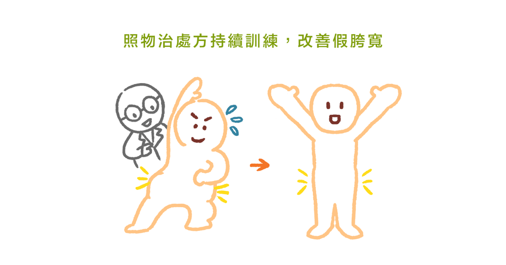 為什麼我的臀部這麼寬?(下):物理治療如何處理假胯寬 - Bestmade 人學院