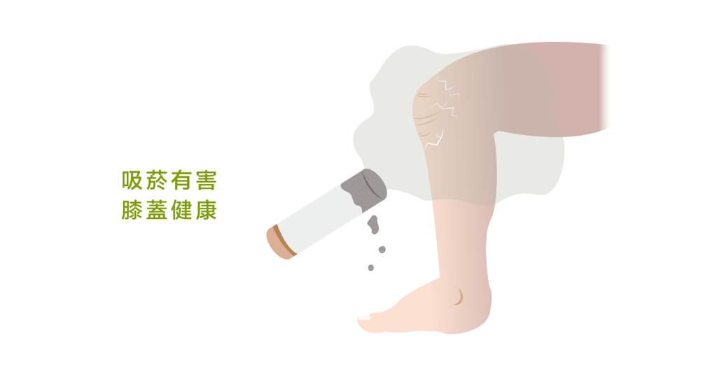 膝蓋喀喀怎麼辦? - Bestmade 人學院
