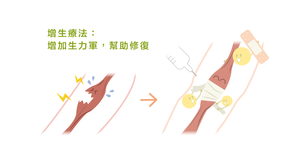增生療法:有效打擊慢性疼痛的最佳利器! - Bestmade 人學院