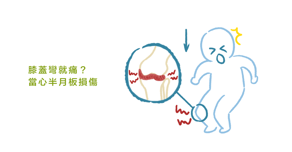 物理師帶你認識:膝蓋痛最常見的原因--半月板 - Bestmade 人學院