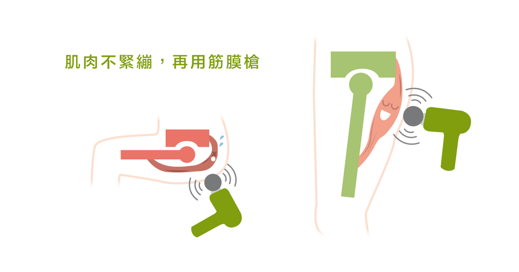 筋膜槍暗藏使用危險!?專業物理治療師示範如何使用不受傷 - Bestmade 人學院