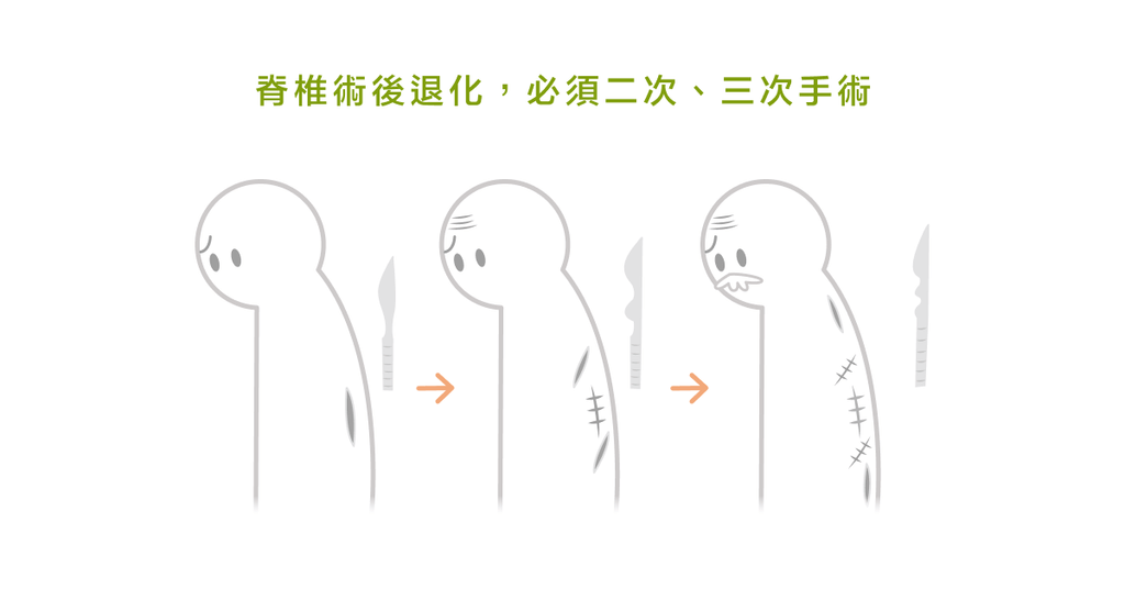 脊椎問題,只要動完手術就好了嗎? - Bestmade 人學院