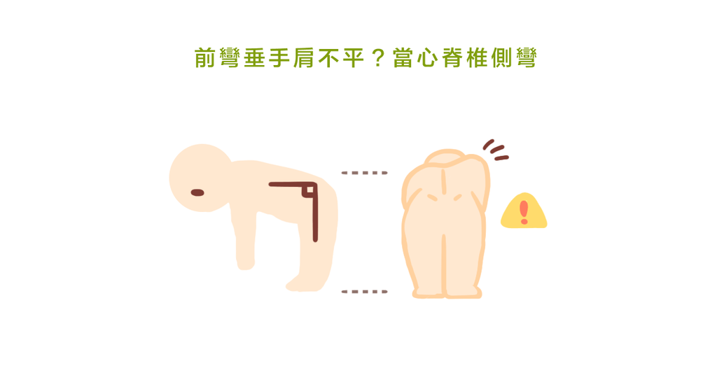 肩膀看起來一高一低,小心脊椎側彎!物理治療師:脊椎側彎與迷思 - Bestmade 人學院