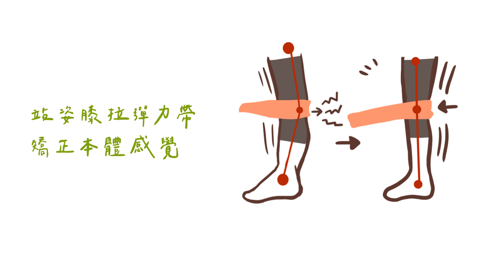 站立時膝蓋往後彎?物理治療師:膝關節過度伸直對身體的傷害(下) - Bestmade 人學院