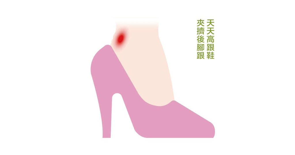 腳底板痛痛的?可能是腳踝夾擠! - Bestmade 人學院