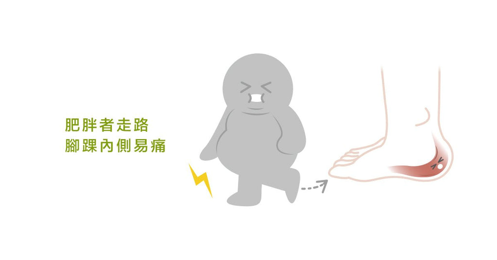 何謂後天扁平足?可能是脛後肌腱失能! - Bestmade 人學院