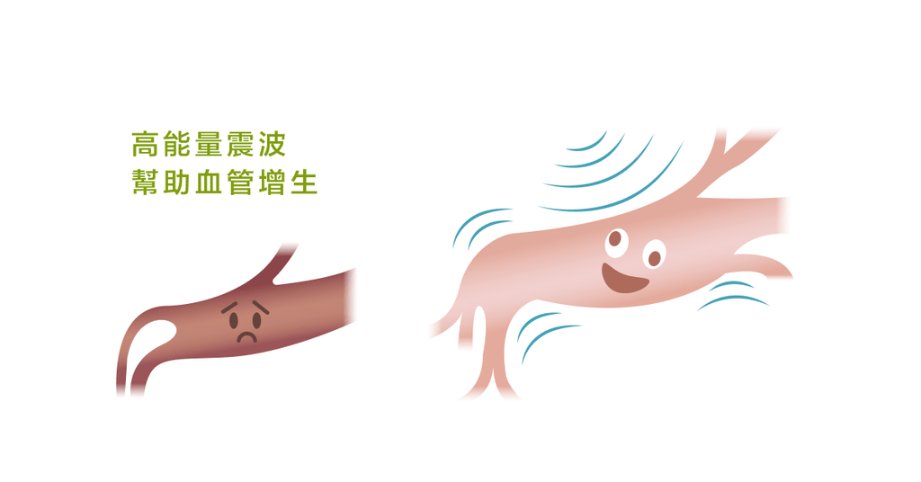 震波治療--有效打擊疼痛 - Bestmade 人學院