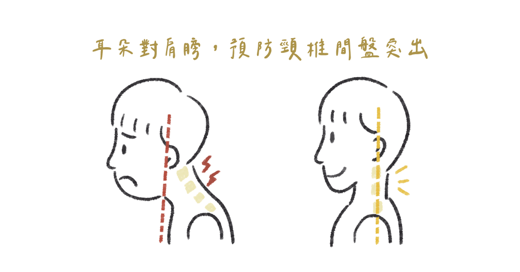 又痛又麻頸椎椎間盤突出怎麼辦? - Bestmade 人學院