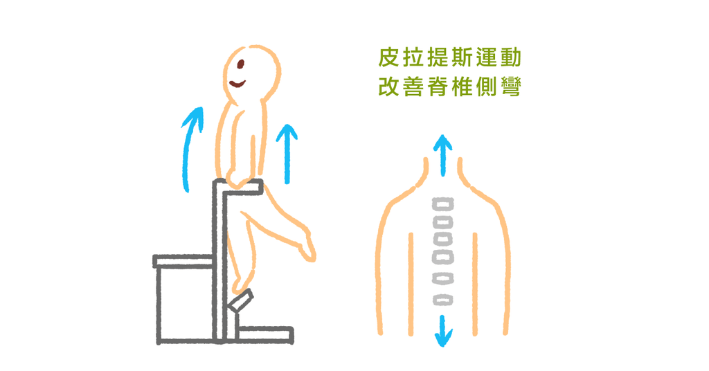 脊椎側彎可以做什麼運動?物理治療師:皮拉提斯改善脊椎側彎! - Bestmade 人學院