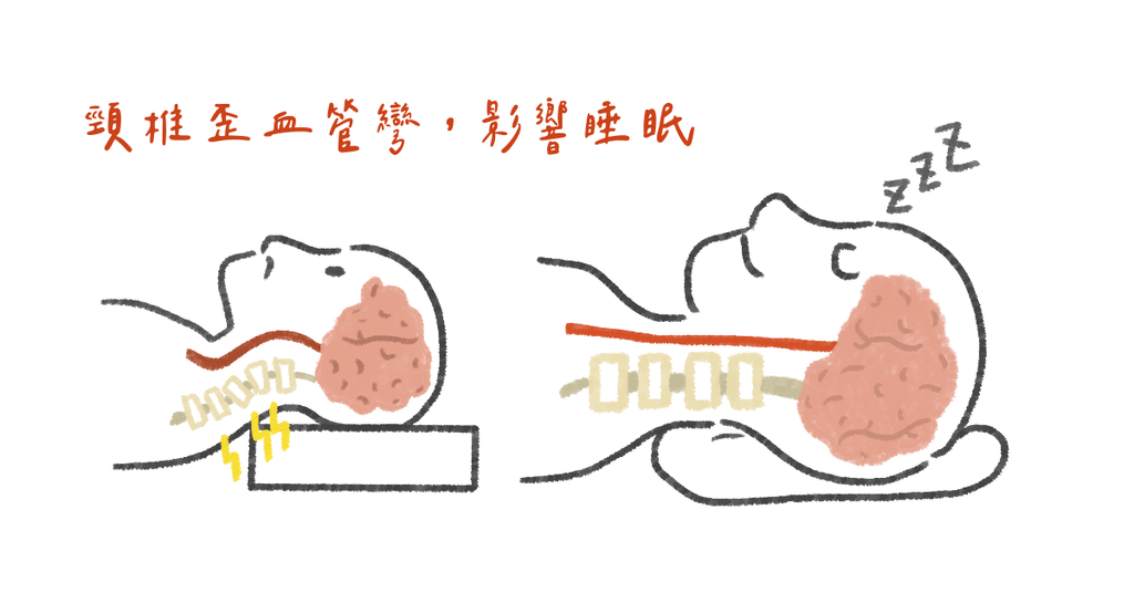 你以為的失眠,可能是頸椎出了問題! - Bestmade 人學院