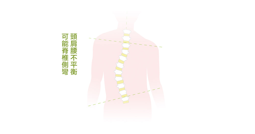 你真的知道什麼是脊椎側彎嗎？
