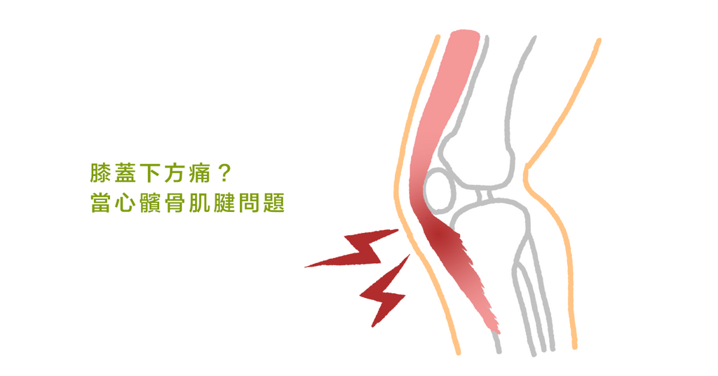 膝蓋痛？最強復健法 （一）：認識髕骨肌腱與受傷成因
