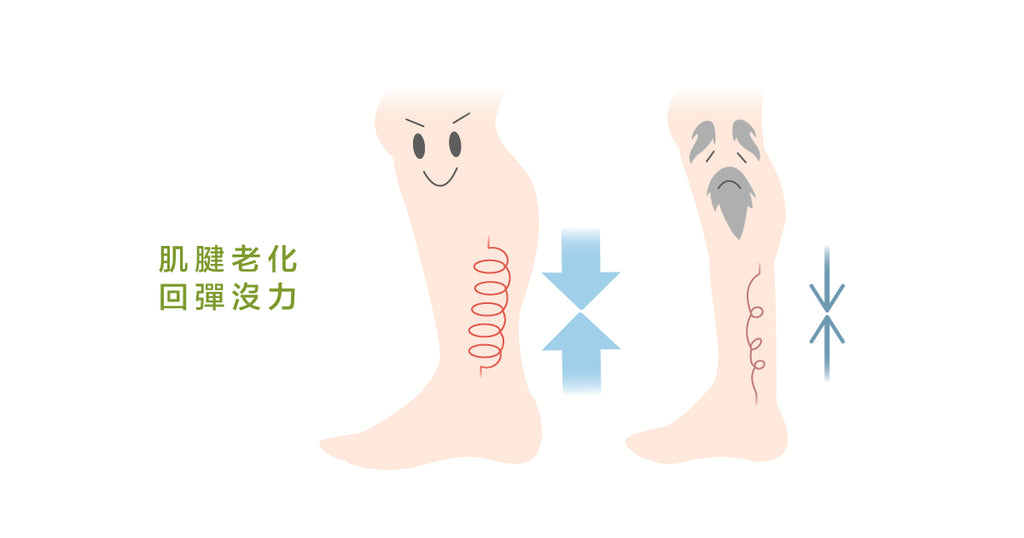 認識阿基里斯腱與肌腱退化病變模型