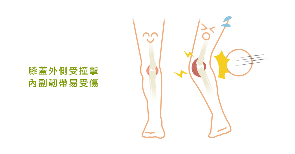 何謂膝蓋內側副韌帶？又有哪些損傷可能性呢？