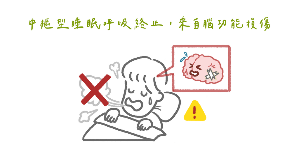 睡眠呼吸中止症遠比你想像的嚴重（上）認識睡眠呼吸中止症症狀