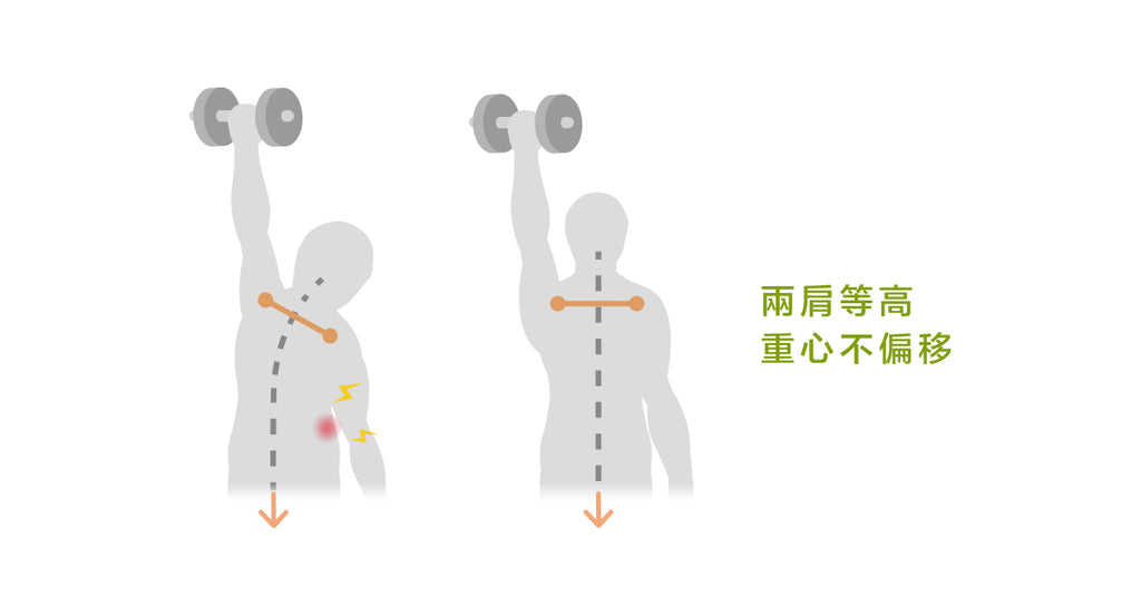 脊椎側彎到底能不能重訓－－側彎重訓安全守則