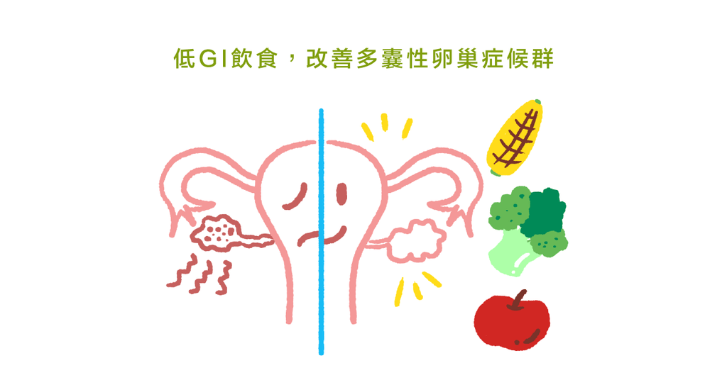 低 GI 與低 GL 食物對多囊性卵巢症候群的益處 - Bestmade 人學院