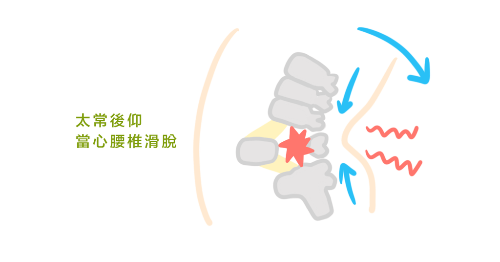 腰痛人注意！不可逆的腰椎滑脫其實很常見！維持腰椎健康的日常小運動（上） - Bestmade 人學院