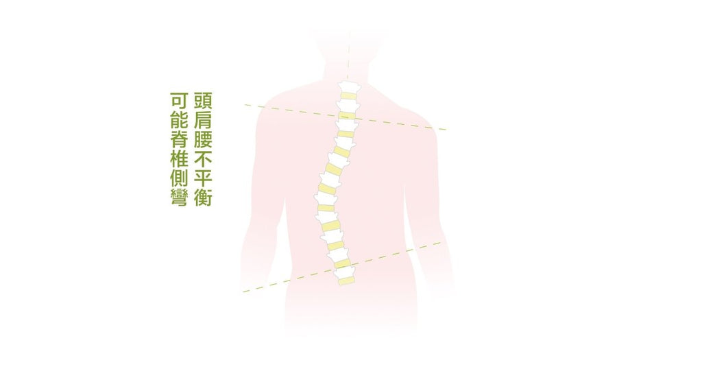 你真的知道什麼是脊椎側彎嗎？ - Bestmade 人學院