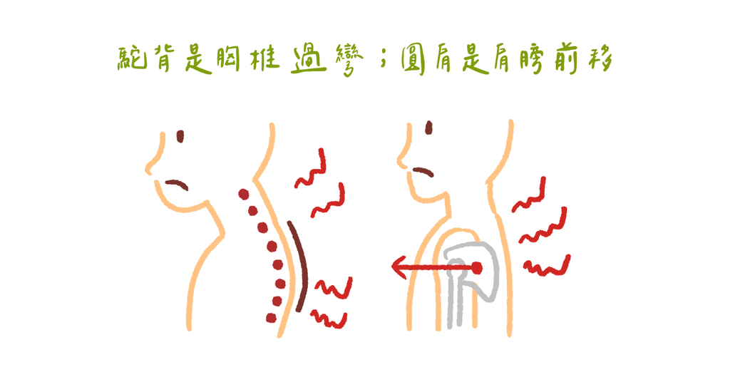 不正確姿勢讓身體提早退化（一）物理治療師：帶你認識駝背與圓肩 - Bestmade 人學院