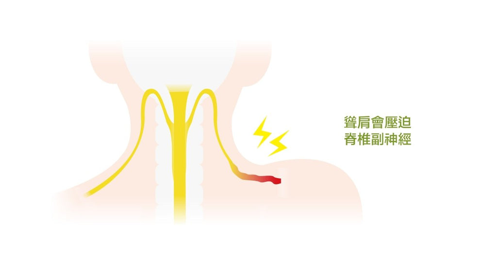 別用「硬頸」趕應景！談談脊副神經夾擠 - Bestmade 人學院