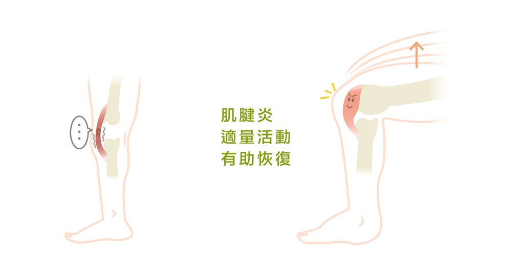 肌腱炎病變，需要知道的訓練方式與「這七件事」 - Bestmade 人學院