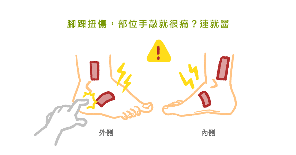 腳踝扭傷的常見問題：常見的扭傷、需不需要去醫院？ - Bestmade 人學院