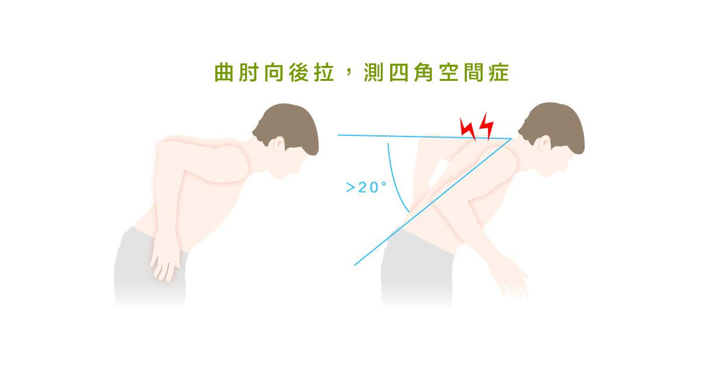 四角空間症侯群的理學檢查與治療方式 - Bestmade 人學院