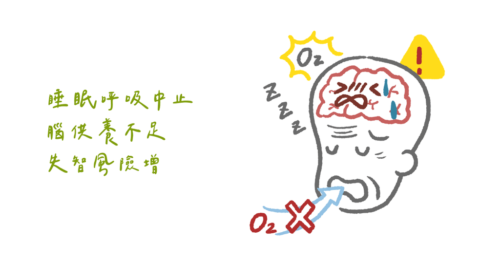 熟齡的睡眠問題（上）阻塞性睡眠呼吸中止症與失智的關係 - Bestmade 人學院